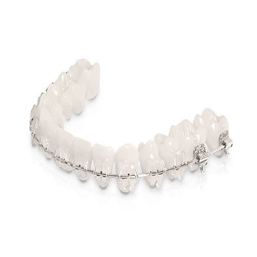 3m-unitek-clarity-self-ligating-ceramic-brackets-500×500-1 (1)